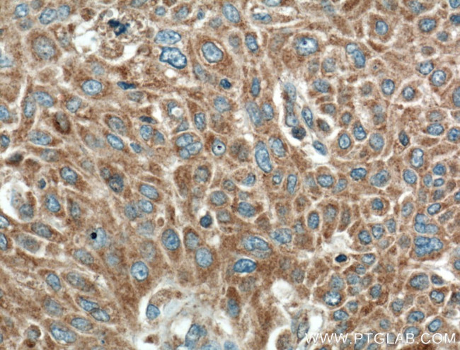 RGS11 Antibody in Immunohistochemistry (Paraffin) (IHC (P))