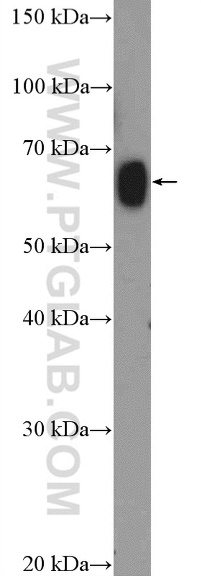 ZNF470 Antibody in Western Blot (WB)