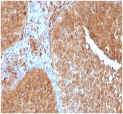 SERBP1/PAI-RBP1 Antibody in Immunohistochemistry (Paraffin) (IHC (P))
