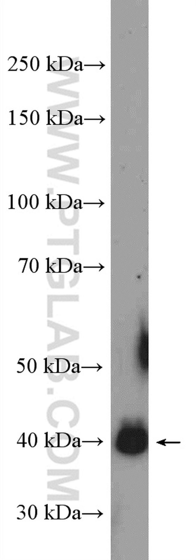 C13orf33 Antibody in Western Blot (WB)