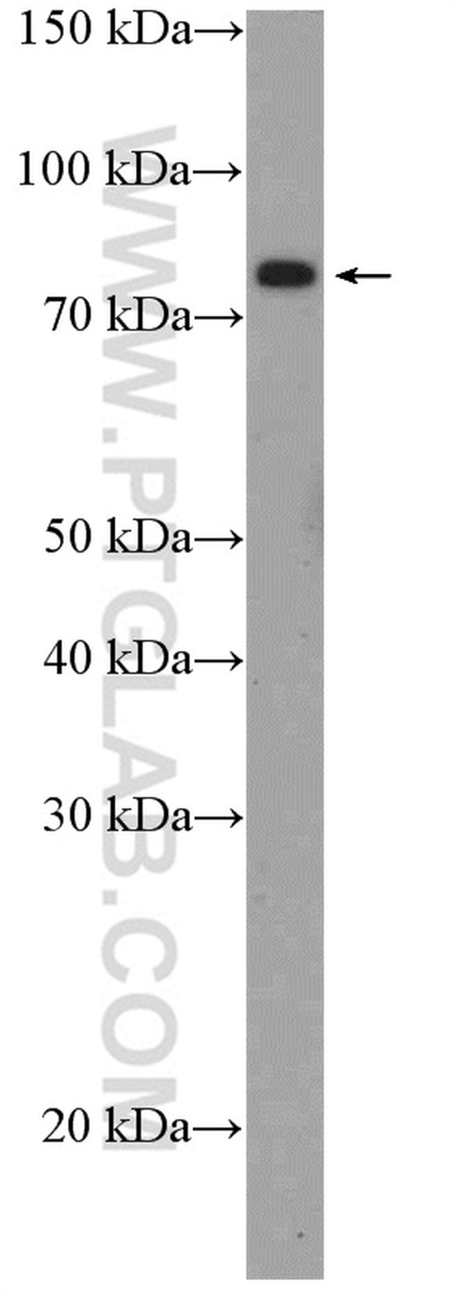 ZBED1 Antibody in Western Blot (WB)