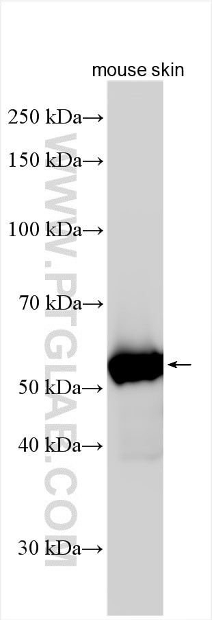 KRT71 Antibody in Western Blot (WB)