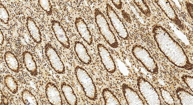 SMEK1 Antibody in Immunohistochemistry (Paraffin) (IHC (P))