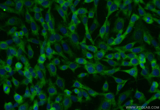 TGF beta 1 Antibody in Immunocytochemistry (ICC/IF)