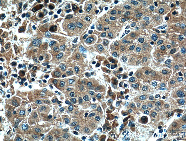 Il2 Antibody in Immunohistochemistry (Paraffin) (IHC (P))