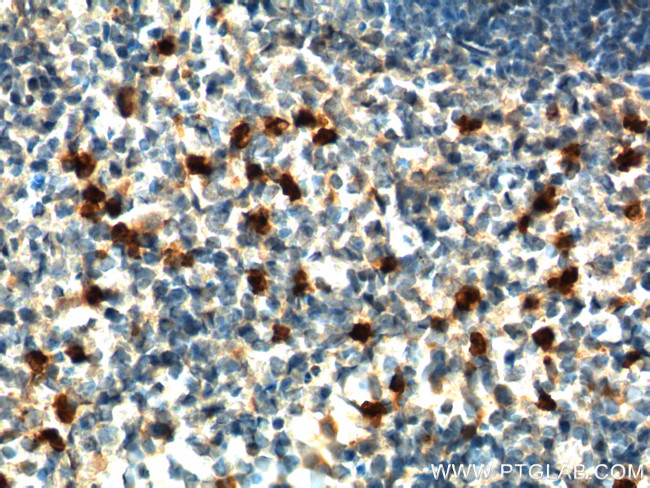IL-17a Antibody in Immunohistochemistry (Paraffin) (IHC (P))