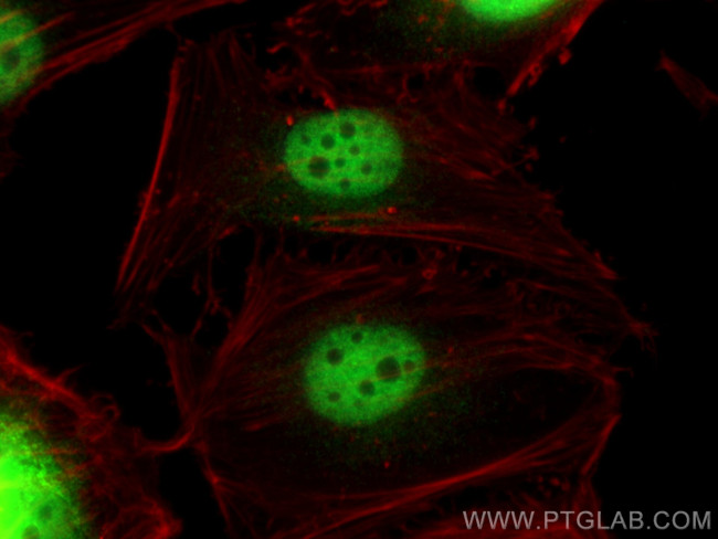 ZNF189 Antibody in Immunocytochemistry (ICC/IF)