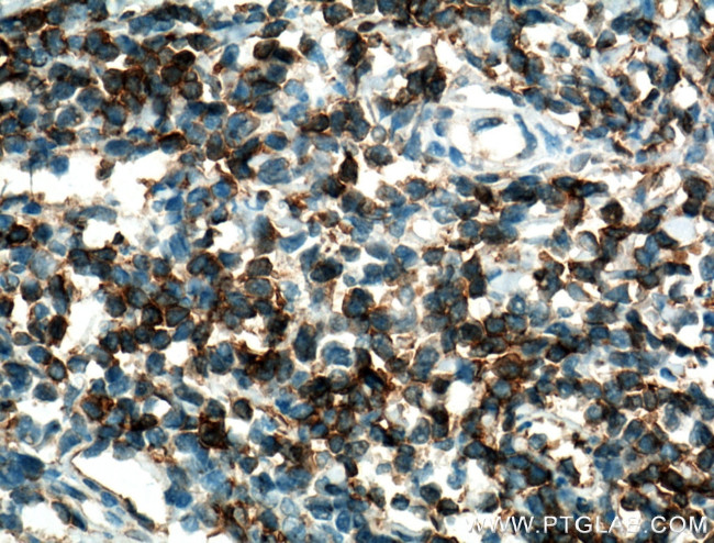 CD28 Antibody in Immunohistochemistry (Paraffin) (IHC (P))