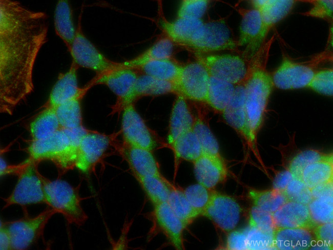 GDNF Antibody in Immunocytochemistry (ICC/IF)