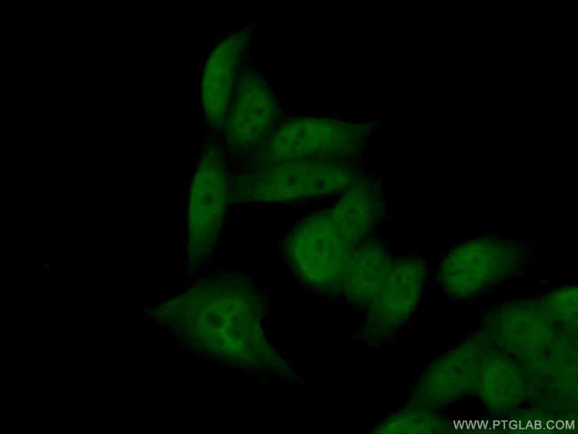 SNAI1 Antibody in Immunocytochemistry (ICC/IF)