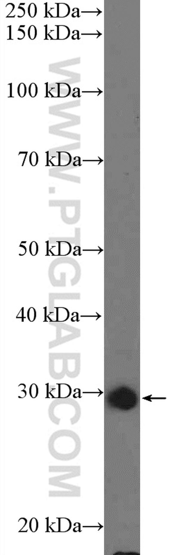 C15orf23 Antibody in Western Blot (WB)