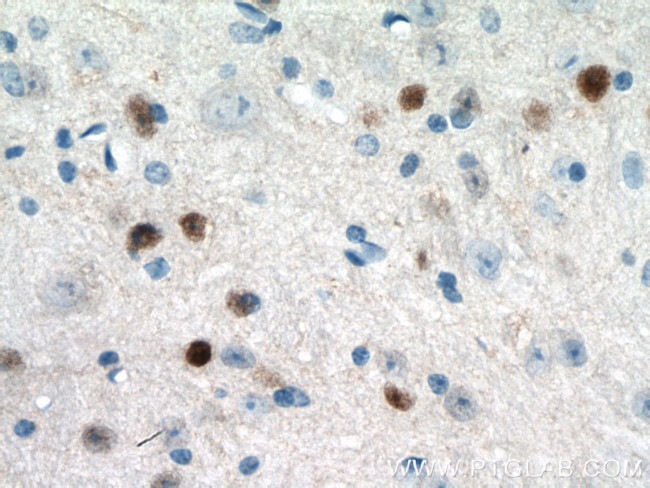 c-FOS Antibody in Immunohistochemistry (Paraffin) (IHC (P))
