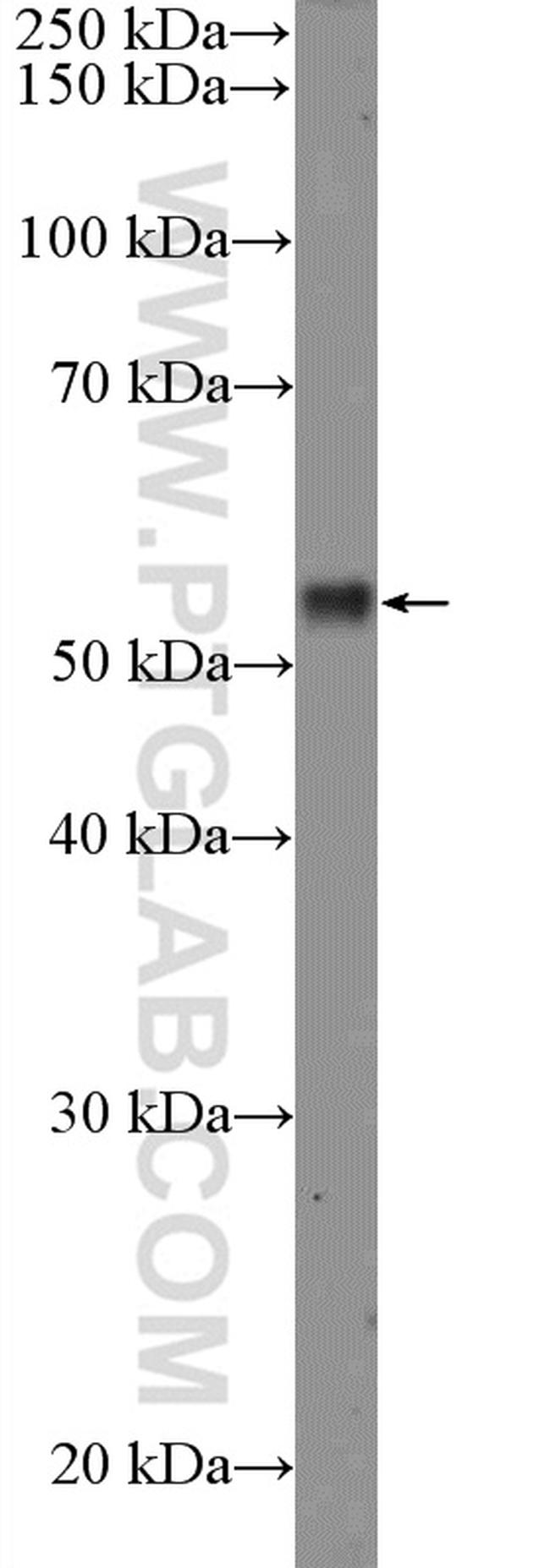 RPS6KB2 Antibody in Western Blot (WB)