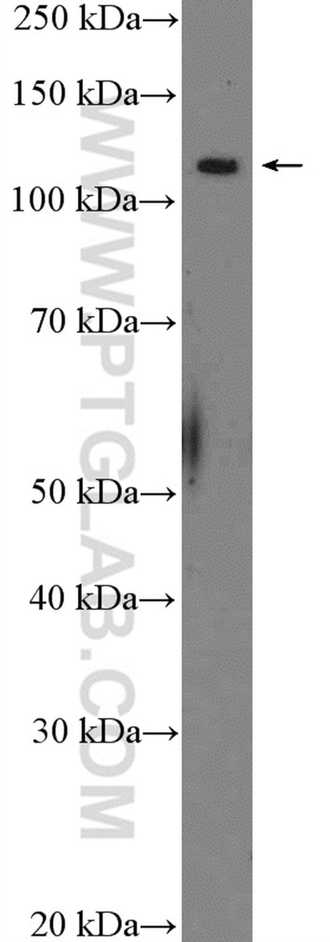 MYT1 Antibody in Western Blot (WB)