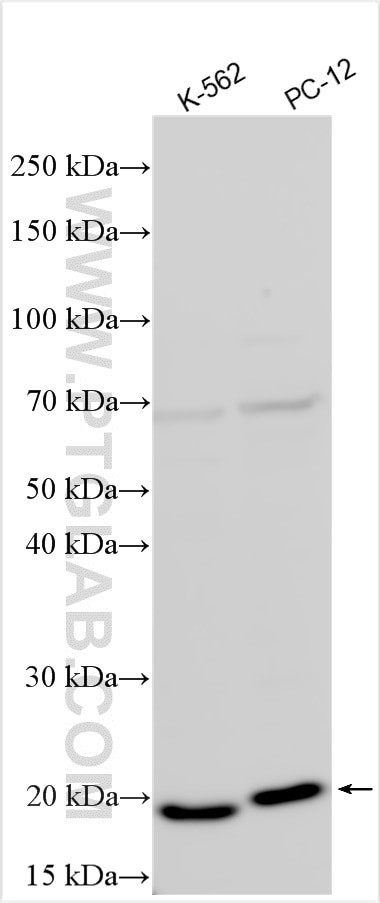 SOCS2 Antibody in Western Blot (WB)