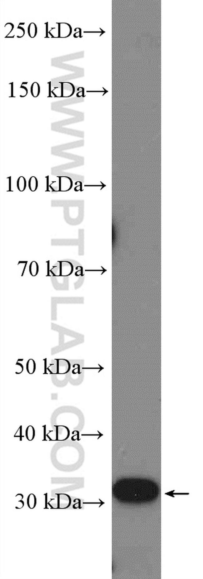 CENPK Antibody in Western Blot (WB)