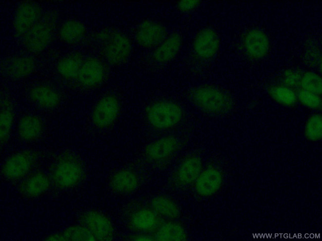 C11orf30 Antibody in Immunocytochemistry (ICC/IF)