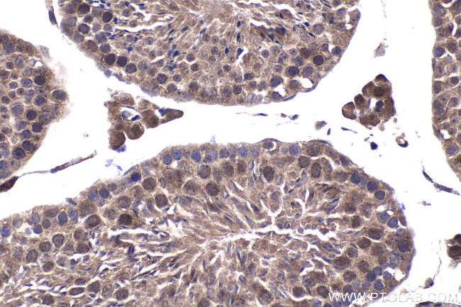 ZNF202 Antibody in Immunohistochemistry (Paraffin) (IHC (P))