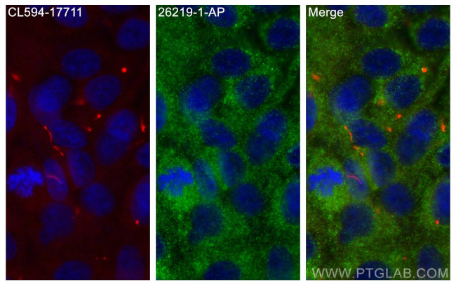 DRC1 Antibody in Immunocytochemistry (ICC/IF)