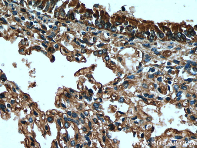 SCGB3A2 Antibody in Immunohistochemistry (Paraffin) (IHC (P))