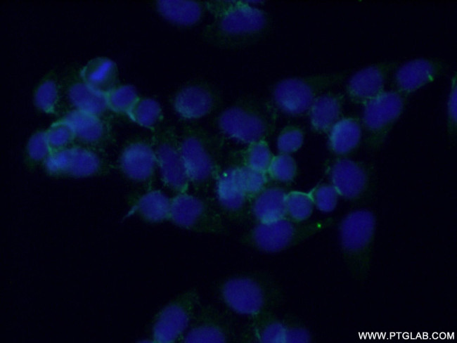 PPAPDC2 Antibody in Immunocytochemistry (ICC/IF)