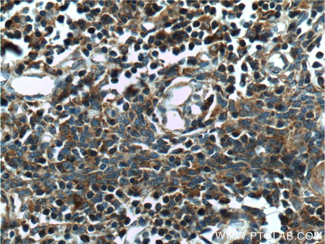 COMMD3 Antibody in Immunohistochemistry (Paraffin) (IHC (P))