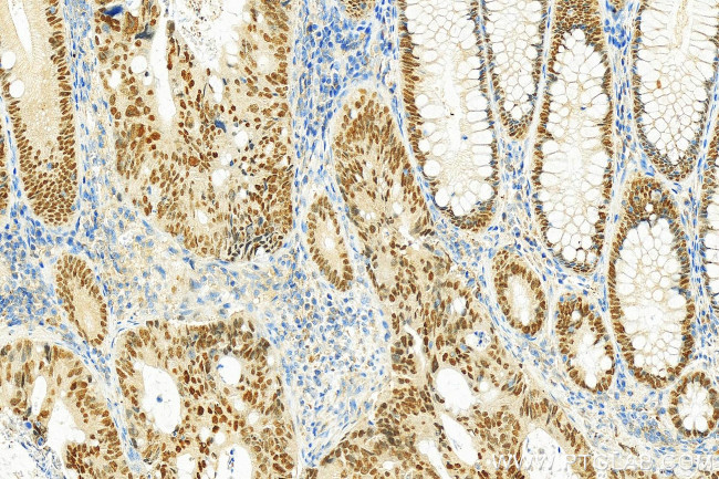 HNF4A Antibody in Immunohistochemistry (Paraffin) (IHC (P))