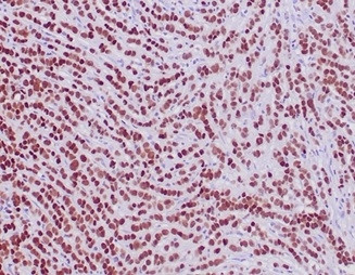 GATA-3 (Breast and Urothelial Marker) Antibody in Immunohistochemistry (Paraffin) (IHC (P))
