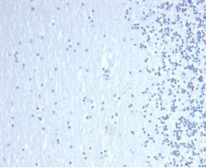 GATA-3 (Center) (Breast and Urothelial Marker) Antibody in Immunohistochemistry (Paraffin) (IHC (P))