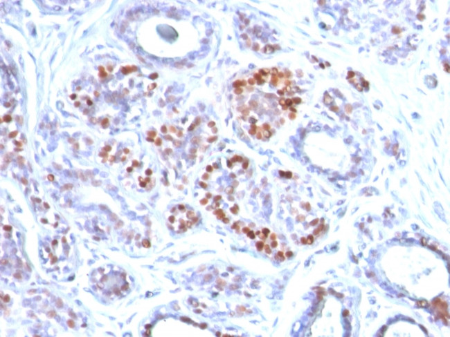 GATA-3 (Breast and Urothelial Marker) Antibody in Immunohistochemistry (Paraffin) (IHC (P))