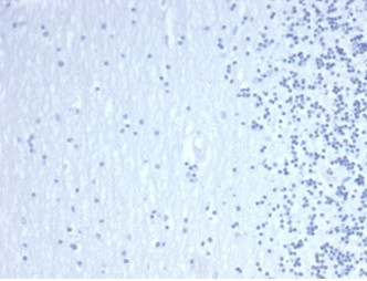 GATA-3 (Breast and Urothelial Marker) Antibody in Immunohistochemistry (Paraffin) (IHC (P))