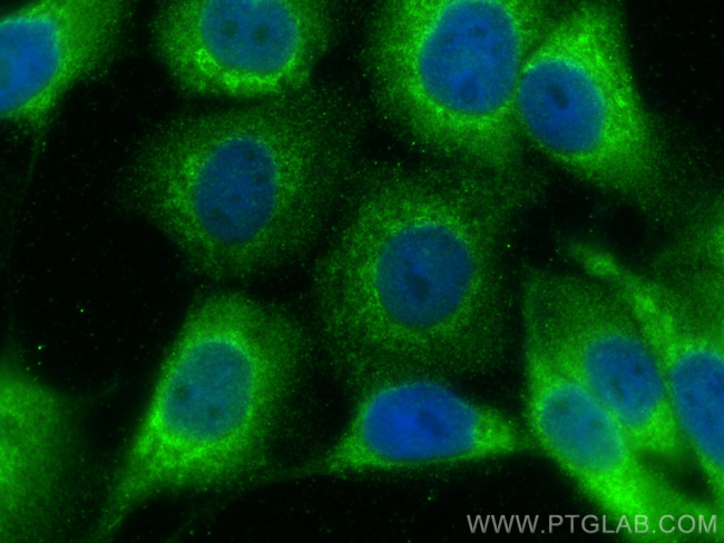 CHM Antibody in Immunocytochemistry (ICC/IF)