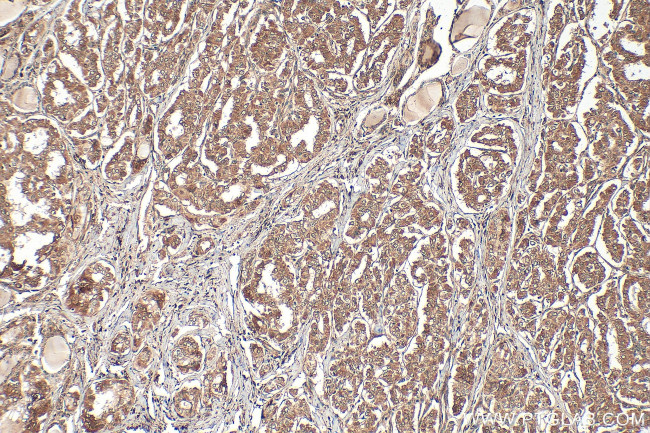 NEK5 Antibody in Immunohistochemistry (Paraffin) (IHC (P))
