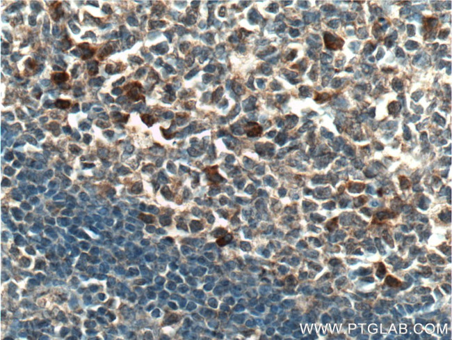 CLEC16A Antibody in Immunohistochemistry (Paraffin) (IHC (P))