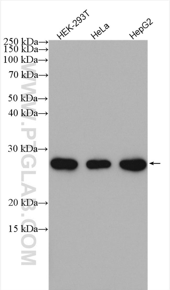SPC24 Antibody in Western Blot (WB)