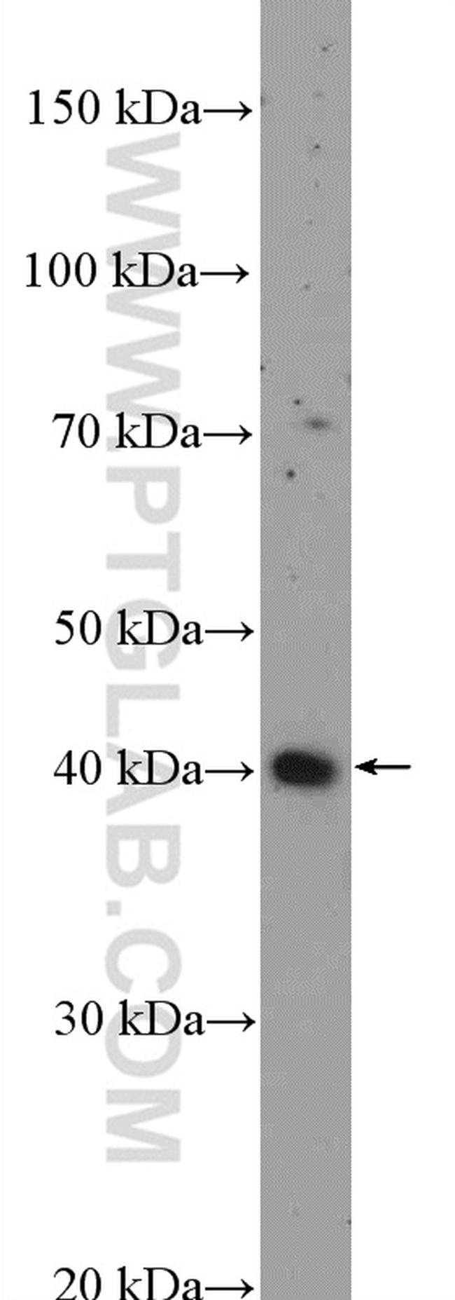 NFKBIL1 Antibody in Western Blot (WB)