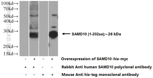 SAMD10 Antibody in Western Blot (WB)