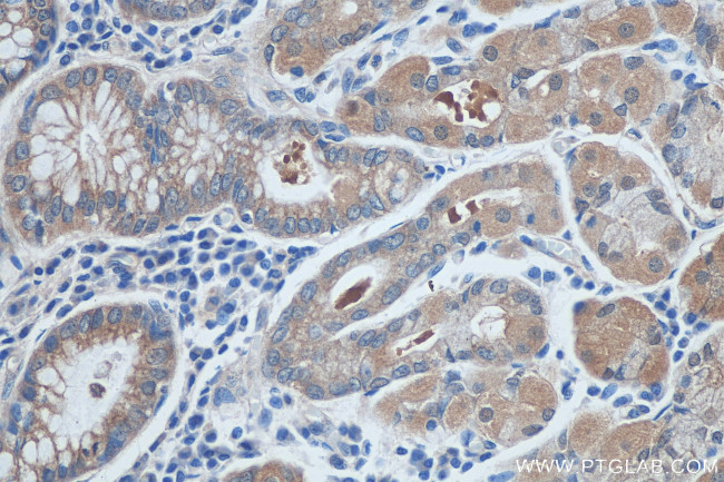 L3MBTL4 Antibody in Immunohistochemistry (Paraffin) (IHC (P))