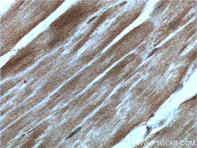 TRIM7 Antibody in Immunohistochemistry (Paraffin) (IHC (P))