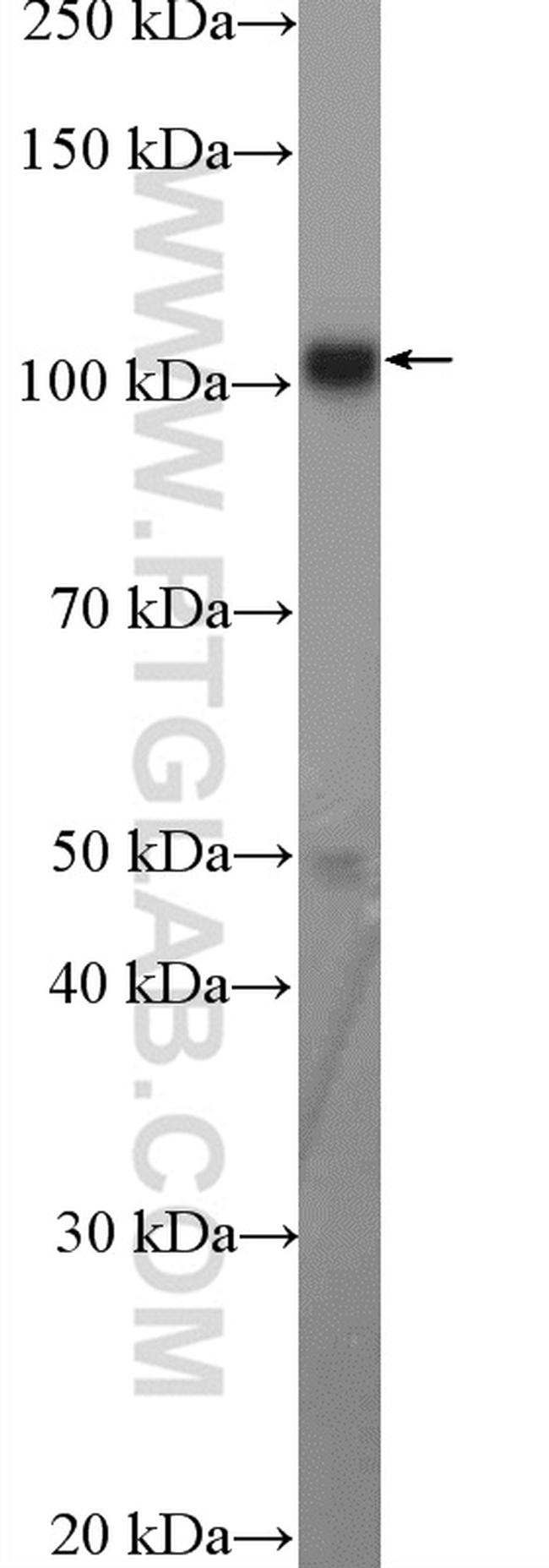 ANKLE2 Antibody in Western Blot (WB)