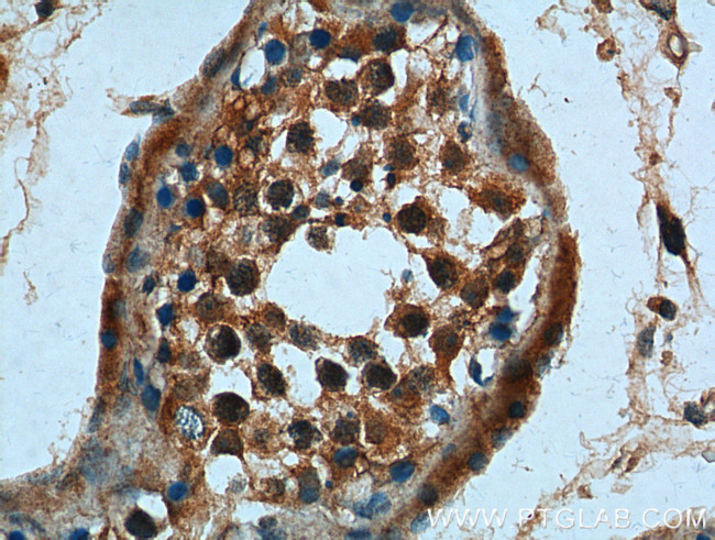 CCDC68 Antibody in Immunohistochemistry (Paraffin) (IHC (P))