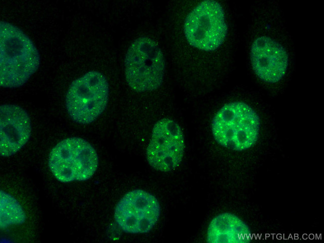 ZNF641 Antibody in Immunocytochemistry (ICC/IF)