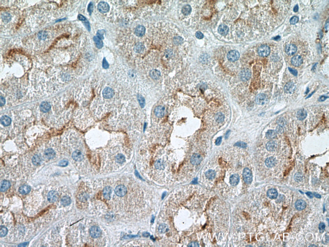 RNF144B/IBRDC2 Antibody in Immunohistochemistry (Paraffin) (IHC (P))