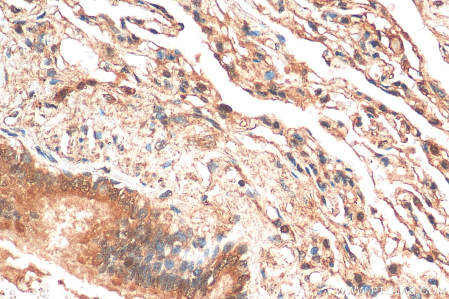 NFATC4 Antibody in Immunohistochemistry (Paraffin) (IHC (P))
