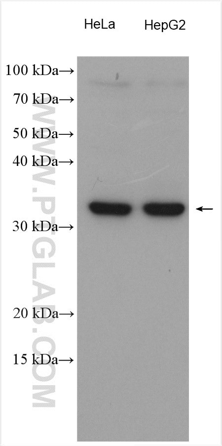 MCU/CCDC109A Antibody in Western Blot (WB)
