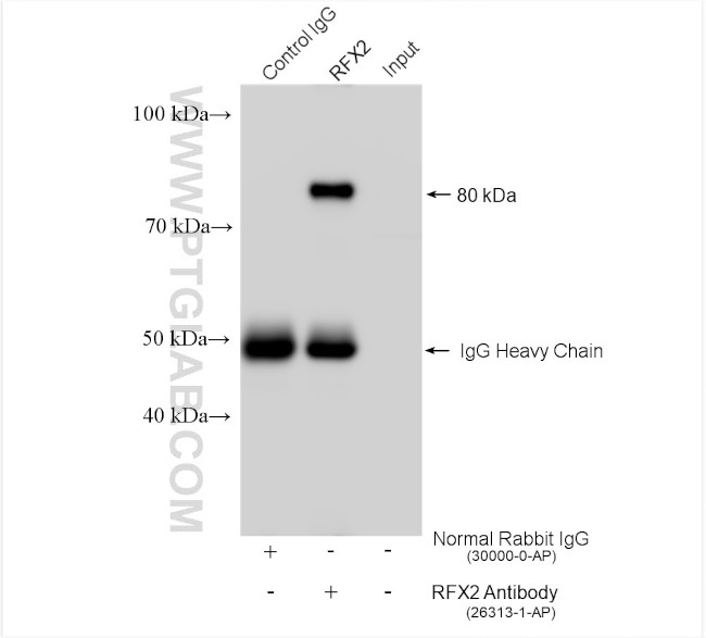 RFX2 Antibody in Immunoprecipitation (IP)