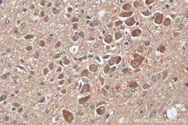 LRRCC1 Antibody in Immunohistochemistry (Paraffin) (IHC (P))