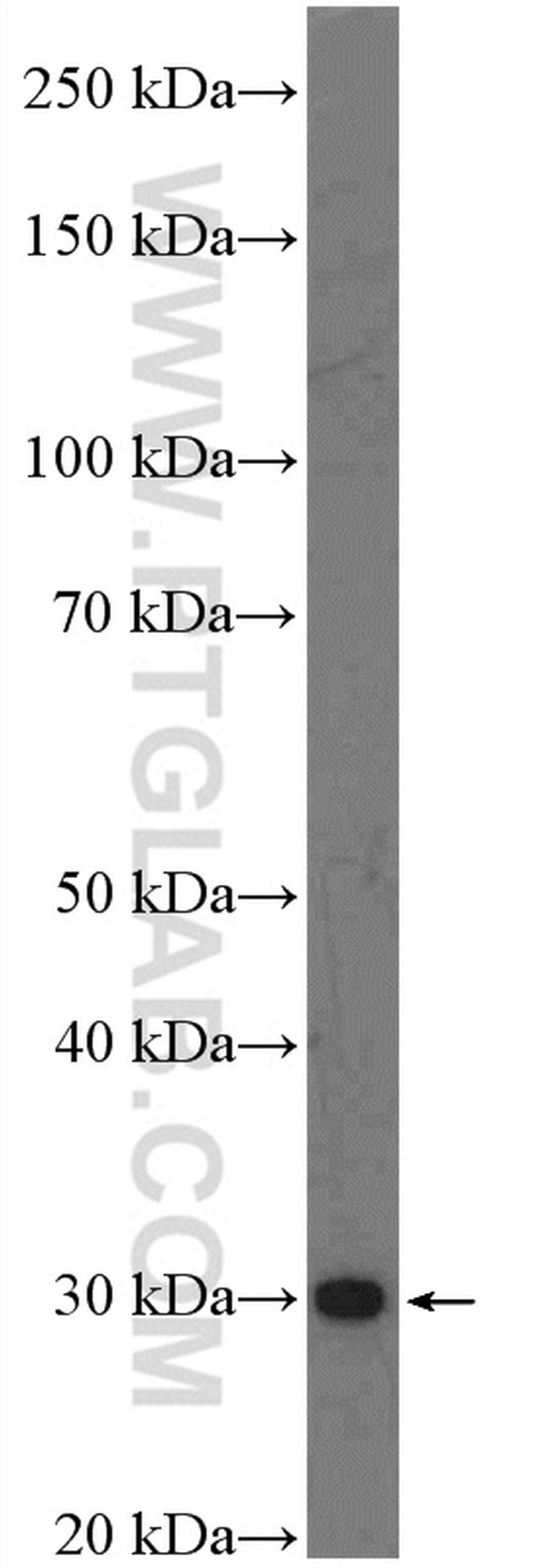 C1orf71 Antibody in Western Blot (WB)