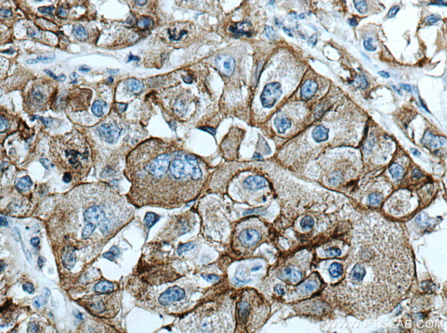 AE2 Antibody in Immunohistochemistry (Paraffin) (IHC (P))