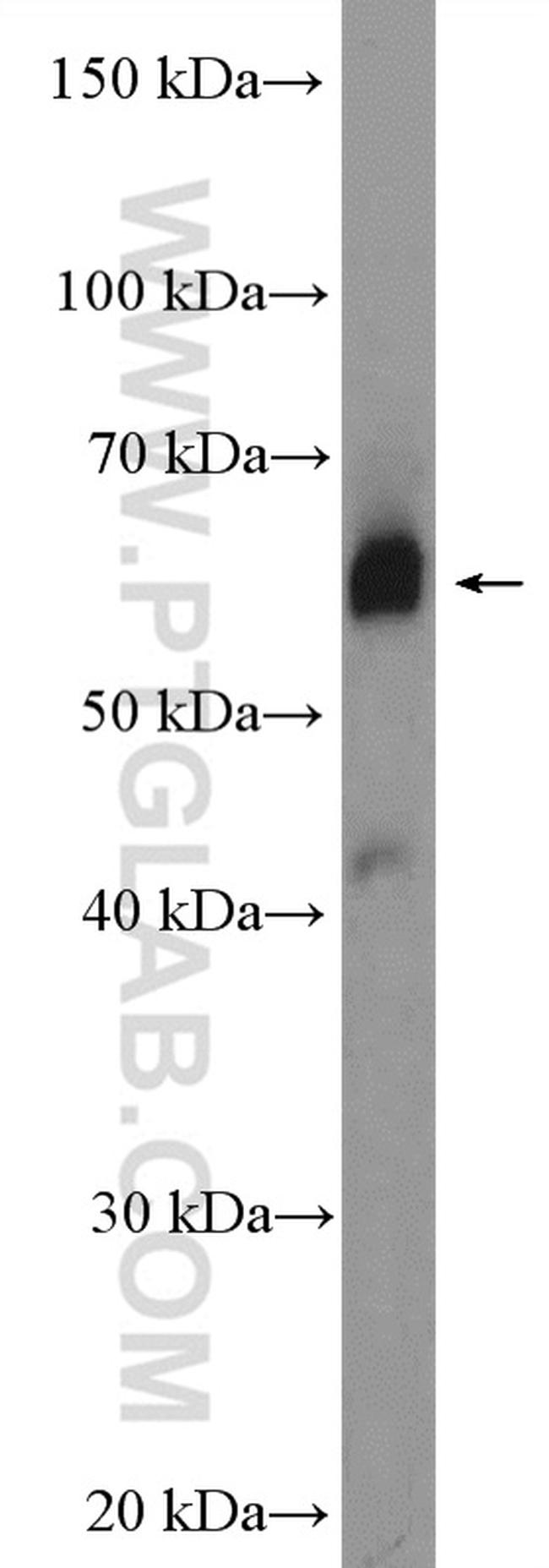 ZNF169 Antibody in Western Blot (WB)